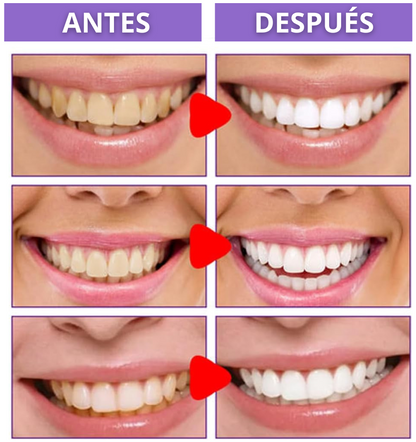 Blanqueador Dental V34 Promoción 1 + 1 Limitada